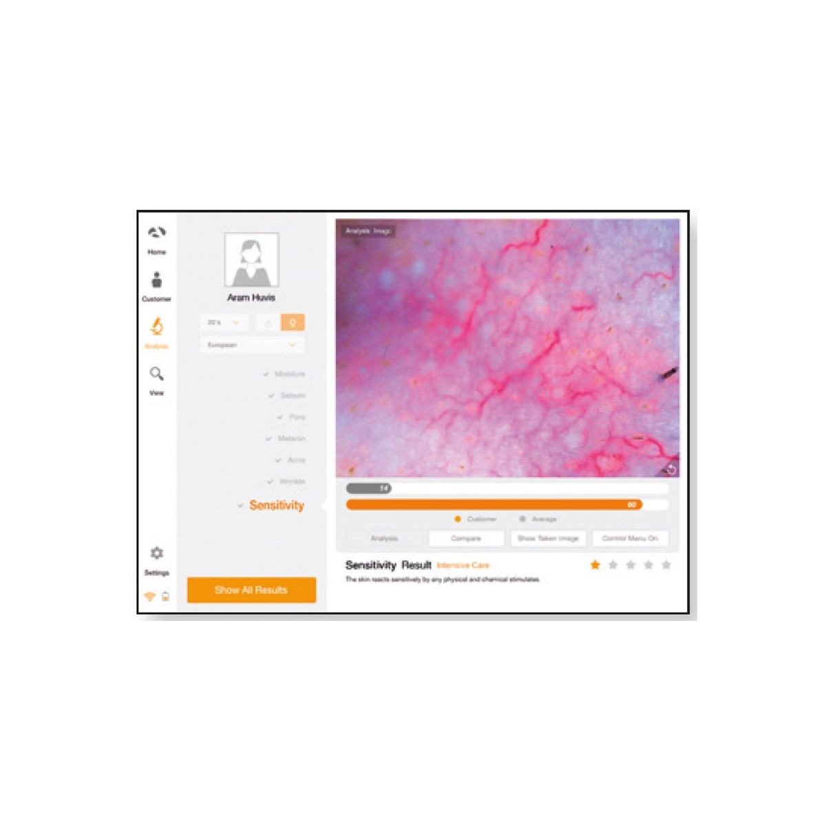 Proshape Skin Diag III