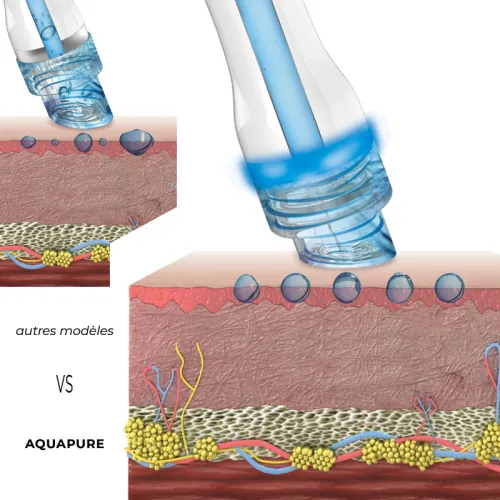 Aquapure I •  Proshape - Beauty Tech®