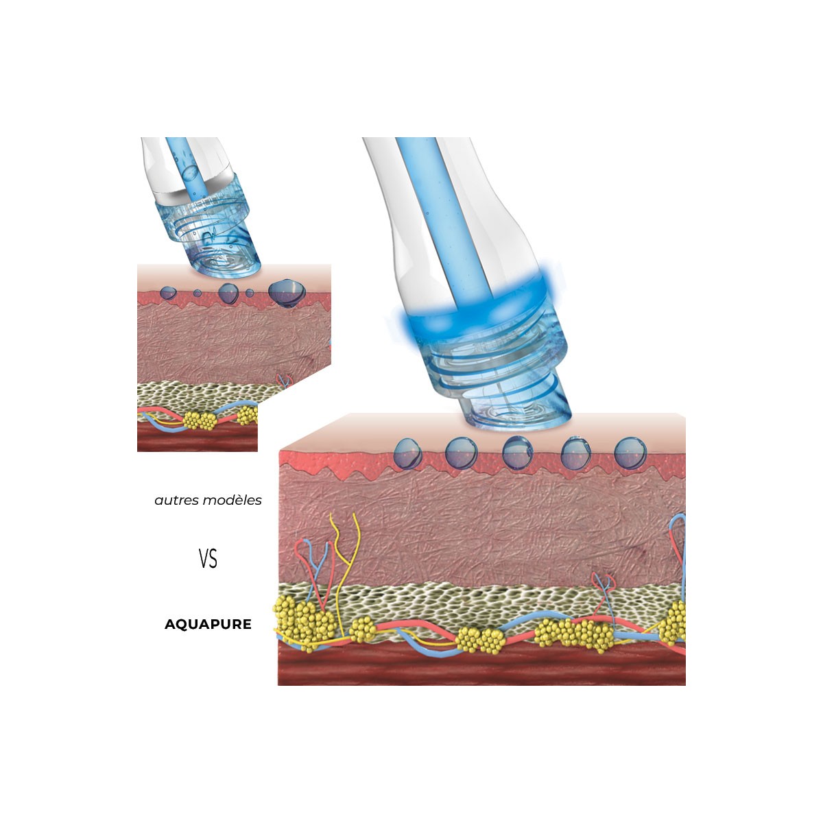 Aquapure I •  Proshape - Beauty Tech®