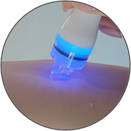 Embouts Cuir Chevelu Aquapure • Proshape - Beauty Tech®