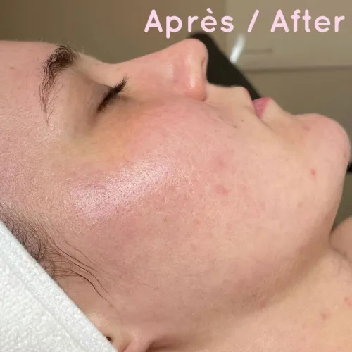 Peeling Nuit Alpha • Yon-Ka