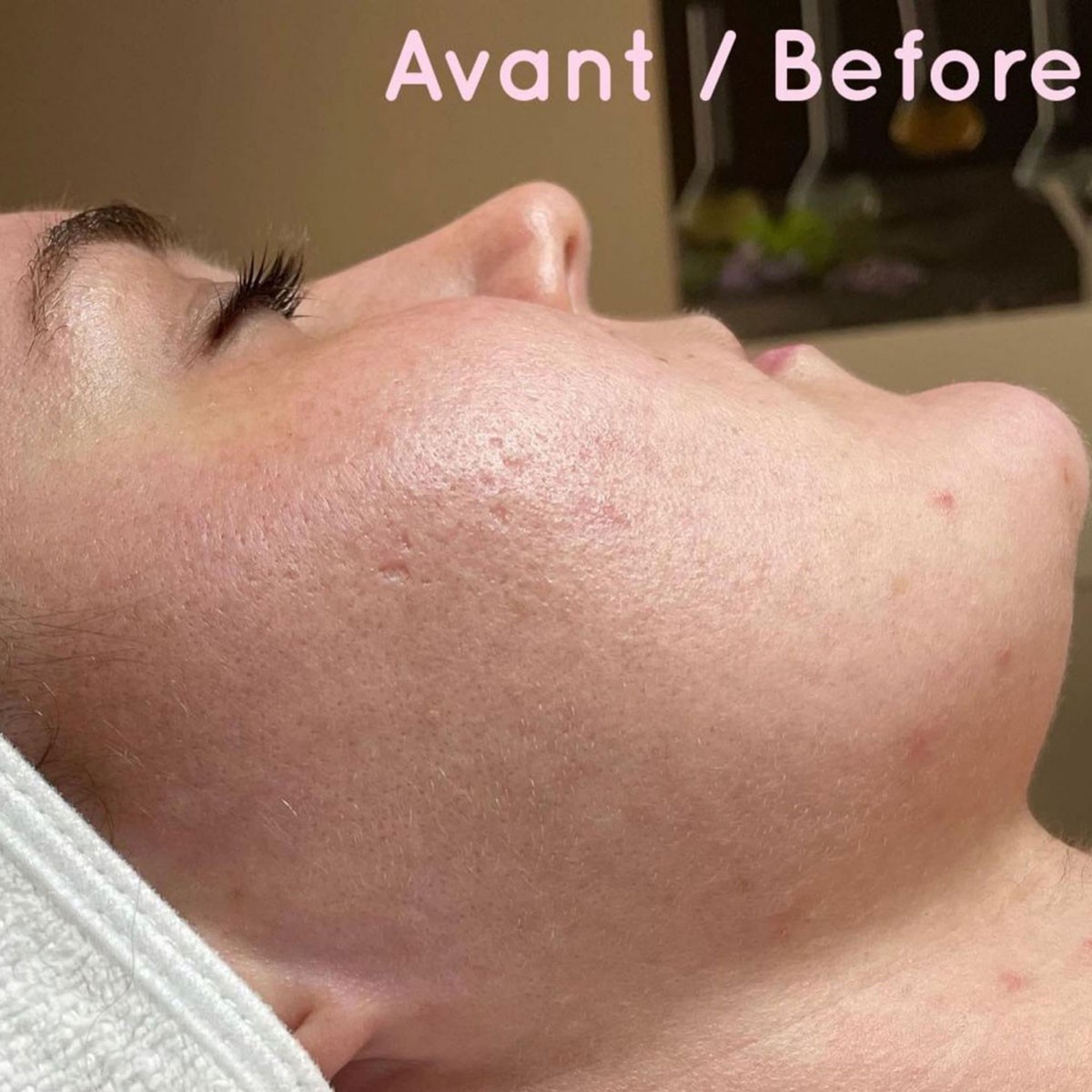 Peeling Nuit Alpha • Yon-Ka