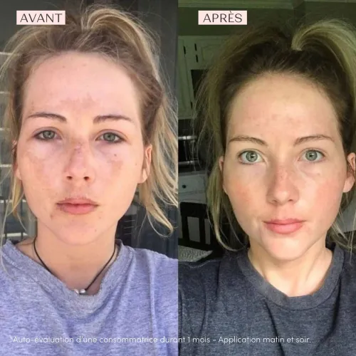 Crème Phyto 58 Ps • Yon-Ka