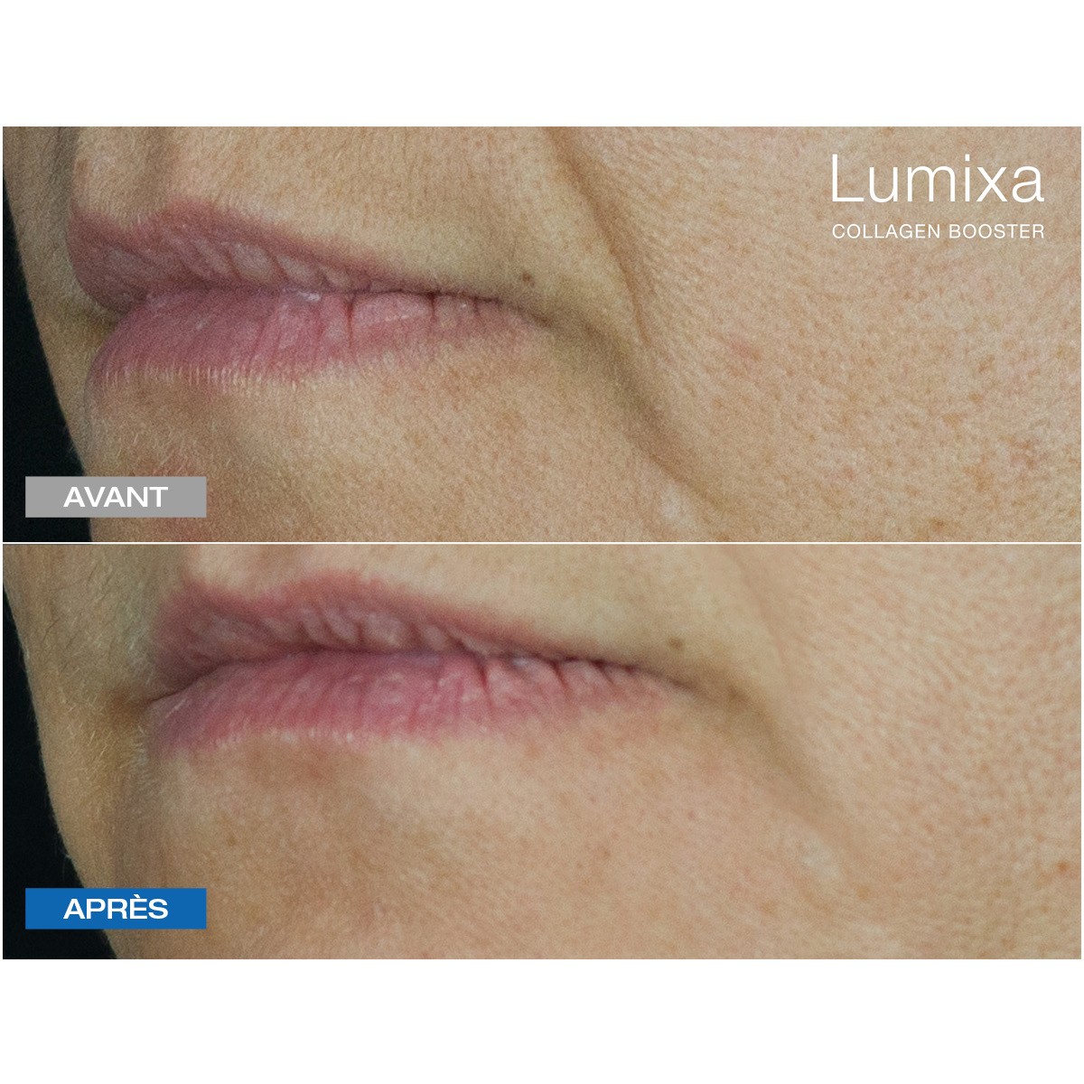 Lumixa • Fb Dermatology