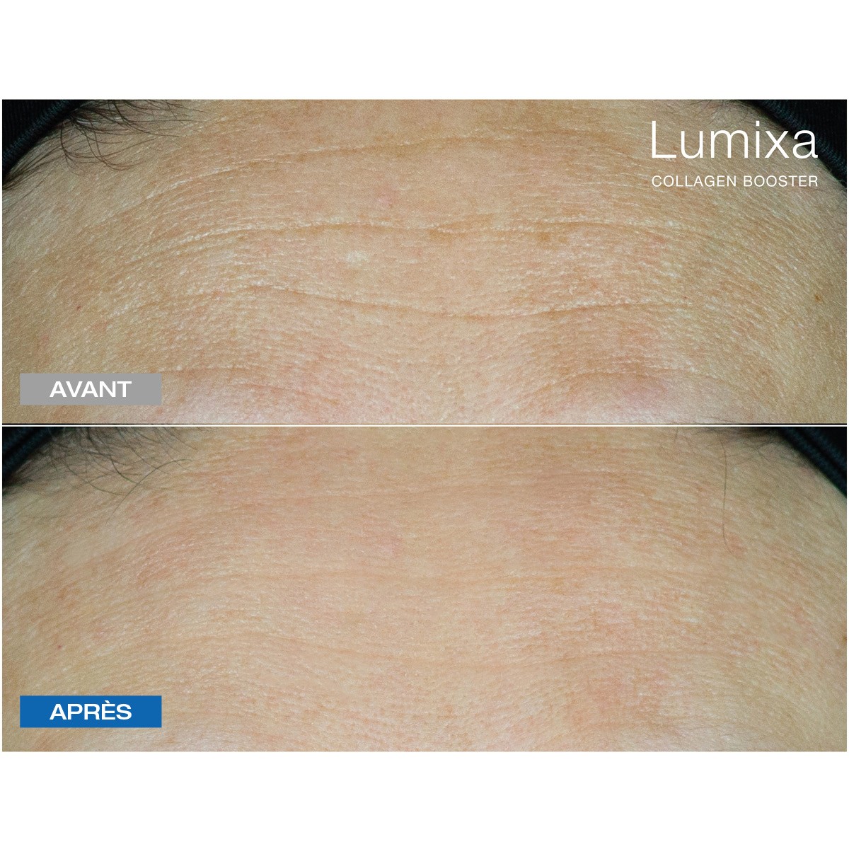 Lumixa • Fb Dermatology