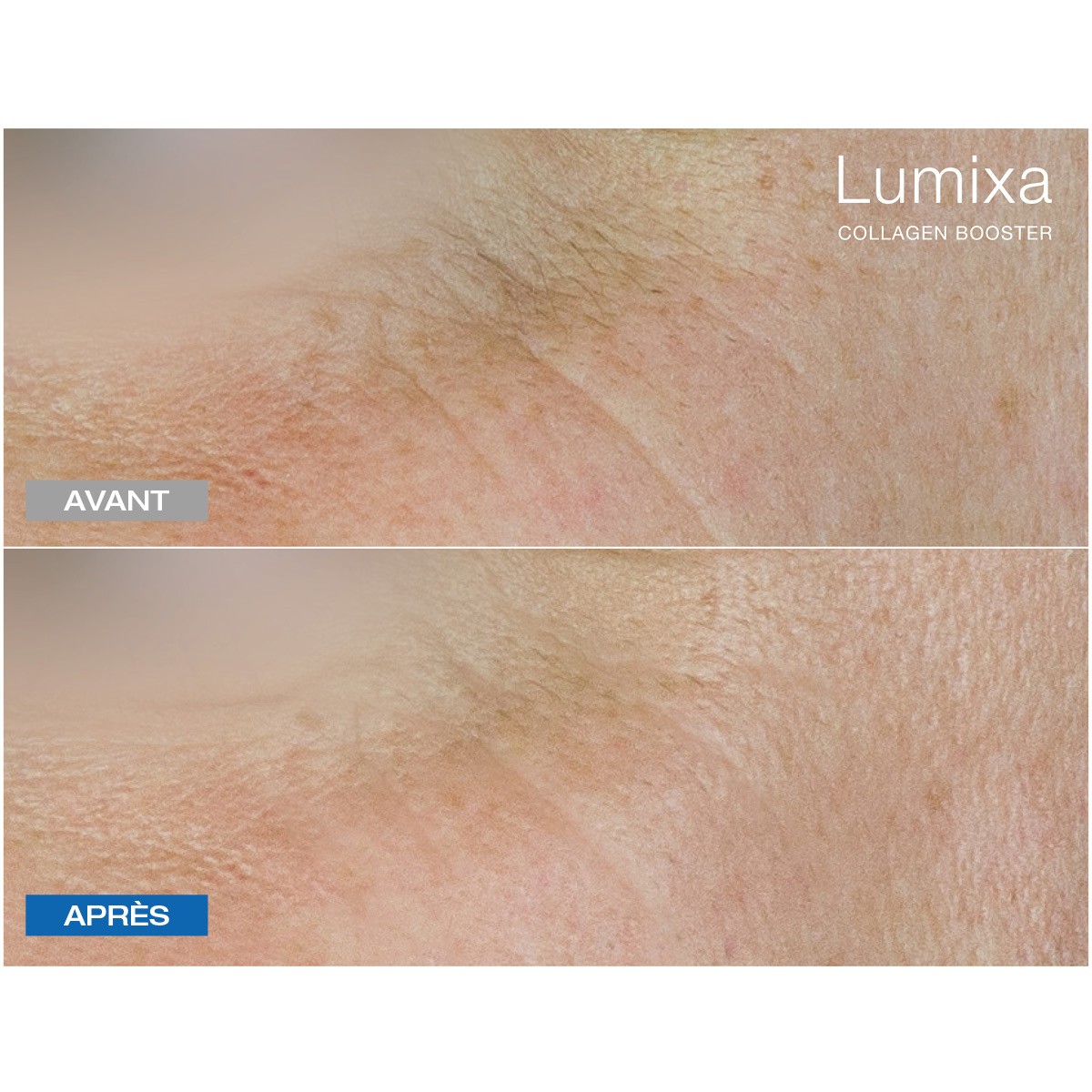 Lumixa • Fb Dermatology