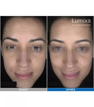 Lumixa • Fb Dermatology