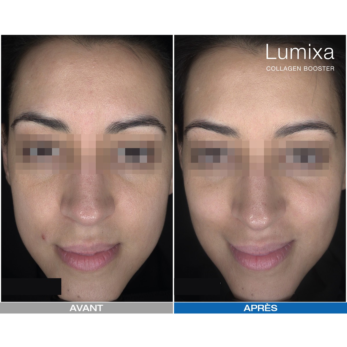Lumixa • Fb Dermatology