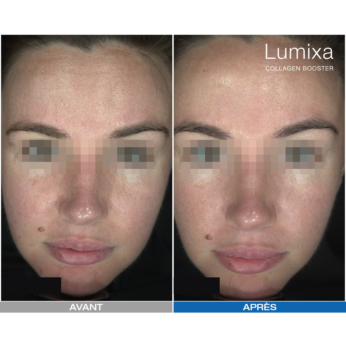 Lumixa • Fb Dermatology