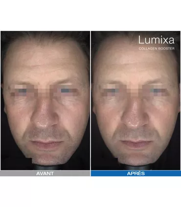 Lumixa • Fb Dermatology