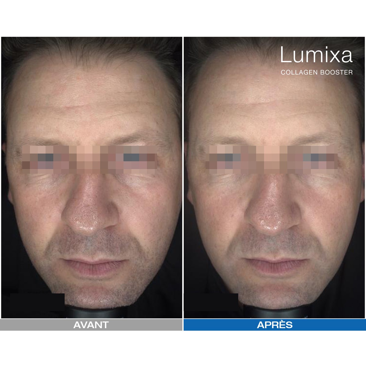 Lumixa • Fb Dermatology