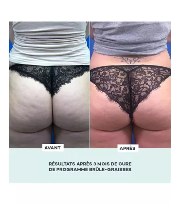 Programme Brûle-Graisses • D-Lab - Beauty Tech