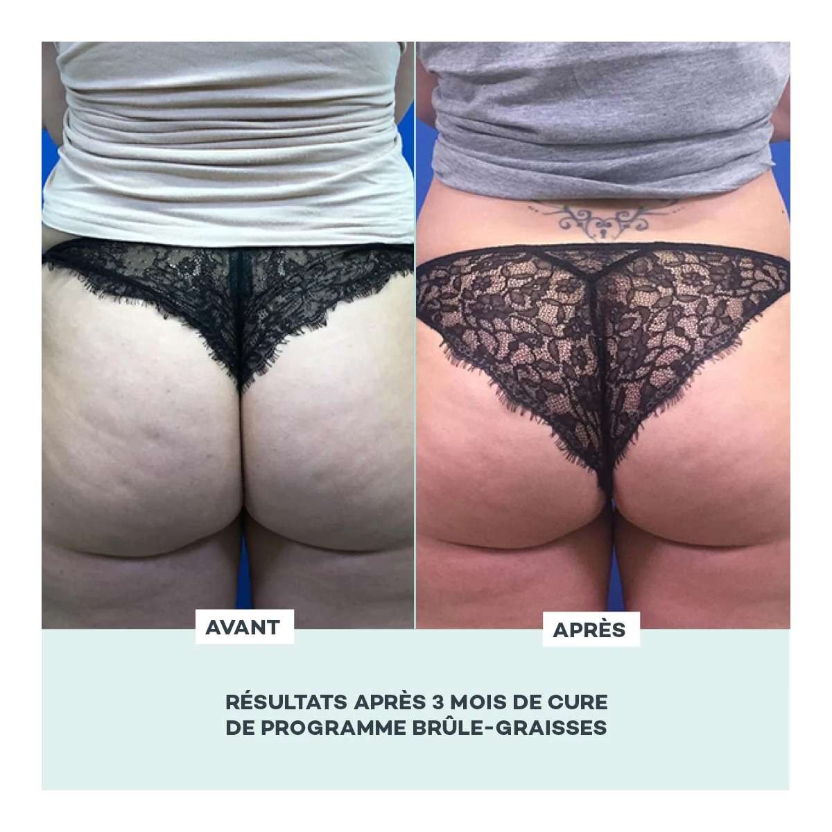 Programme Brûle-Graisses • D-Lab - Beauty Tech