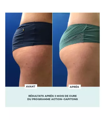 Programme Action-Capitons - D-Lab