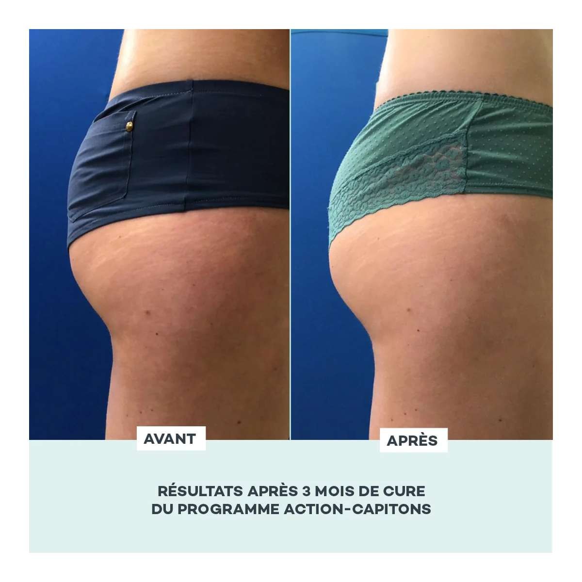 Programme Action-Capitons - D-Lab