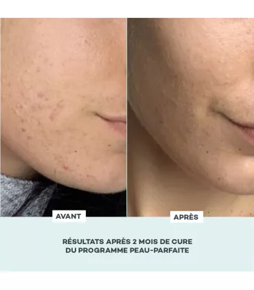 Programme Peau Parfaite • D-Lab - Beauty Tech