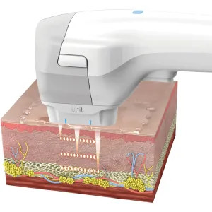 Ulfit - Occasion salon