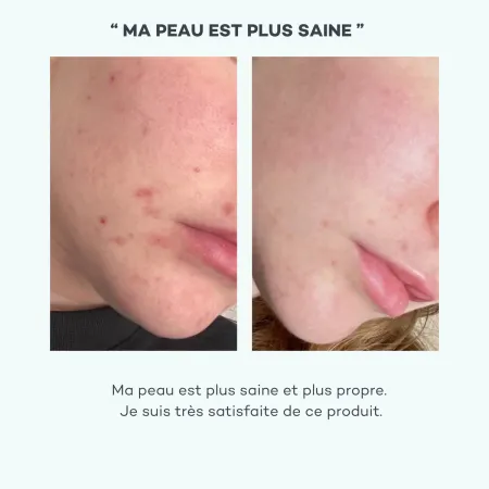 Absolu de Zinc • D-Lab - Beauty Tech