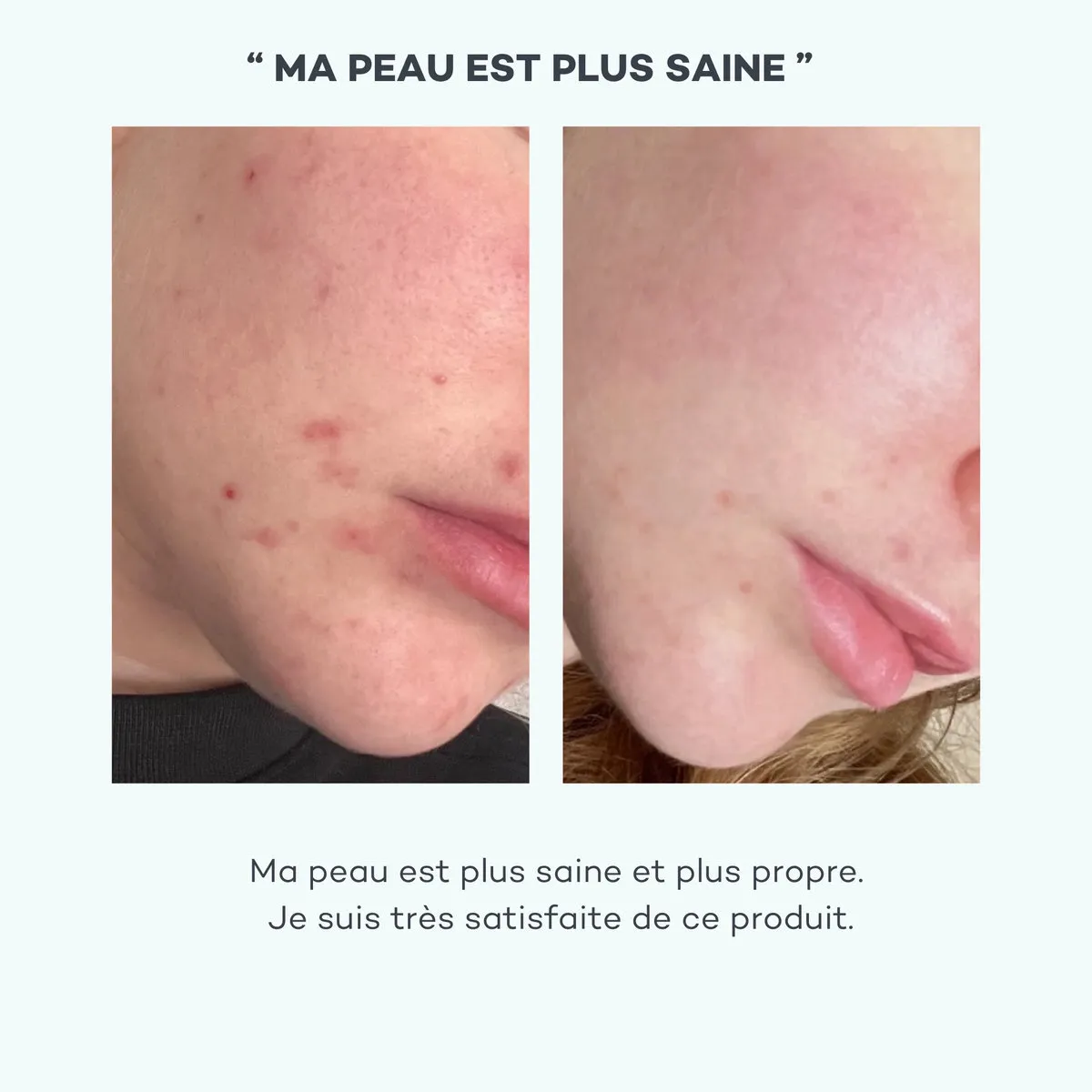 Absolu de Zinc • D-Lab - Beauty Tech