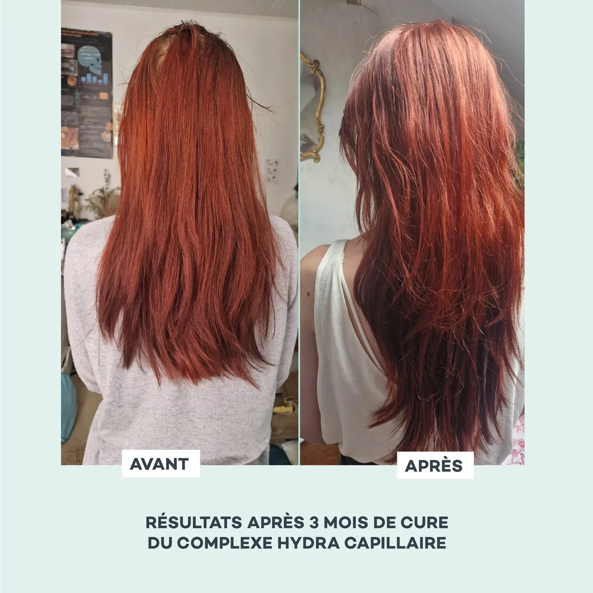 Complexe Hydra-Capillaire • D-Lab - Beauty Tech