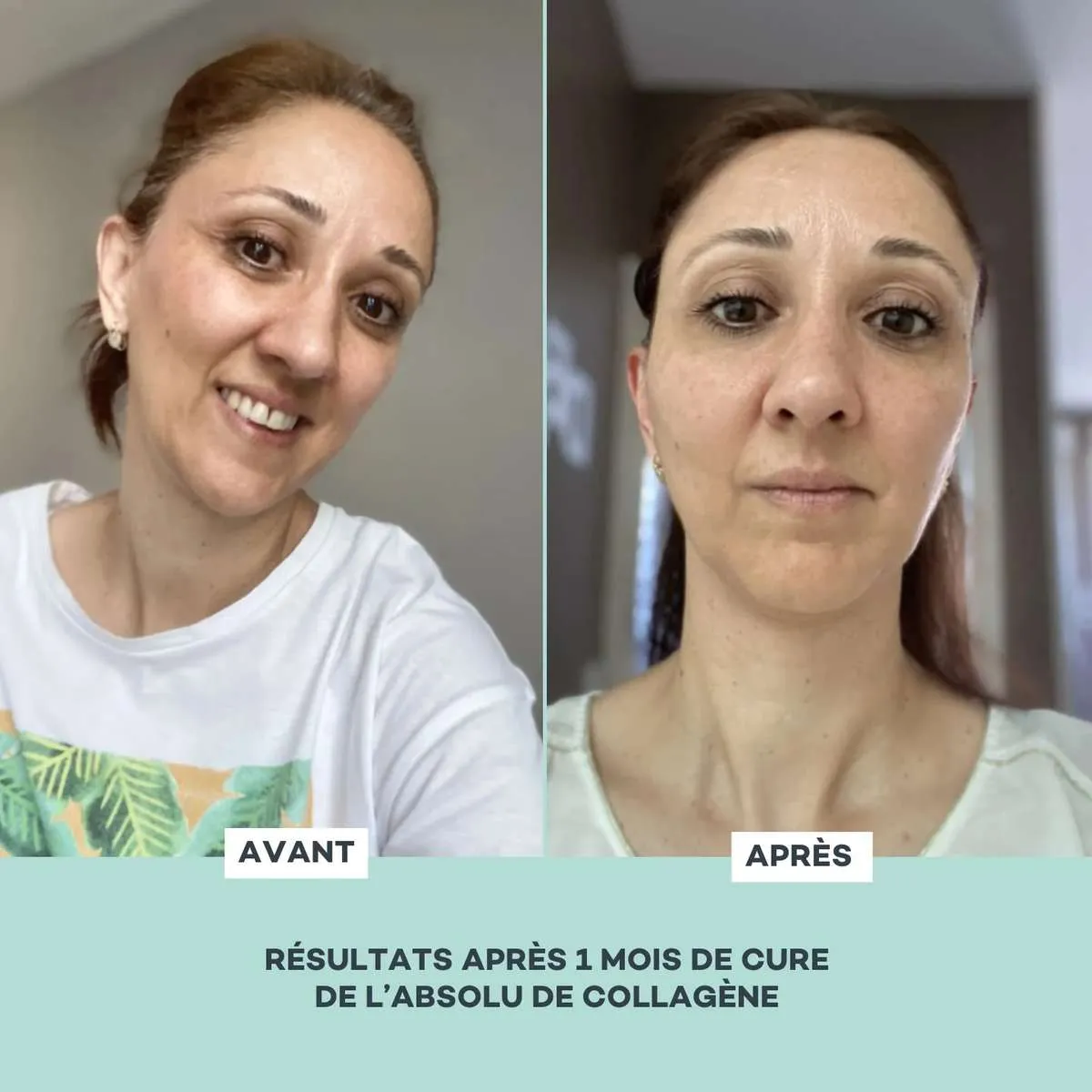 Abolu de Collagène • D-Lab - Beauty Tech